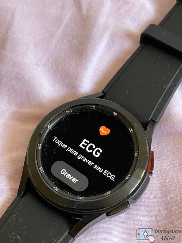 ECG